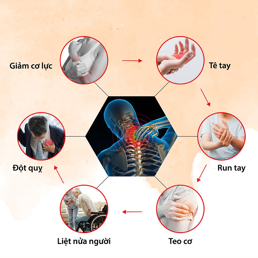 Những triệu chứng đau mỏi vai gáy