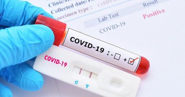Test Covid-19